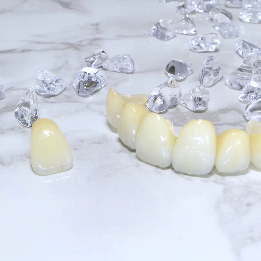 千葉市若葉区のジルコニア治療