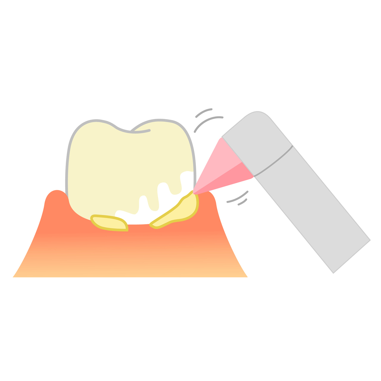 千葉市若葉区の小児歯科