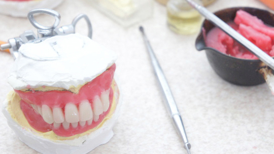 千葉市若葉区の審美歯科（白い詰め物・被せ物）