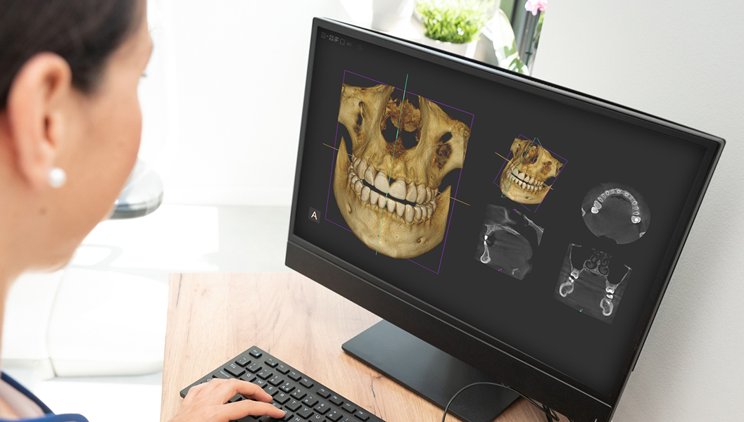 千葉市若葉区の歯周外科治療