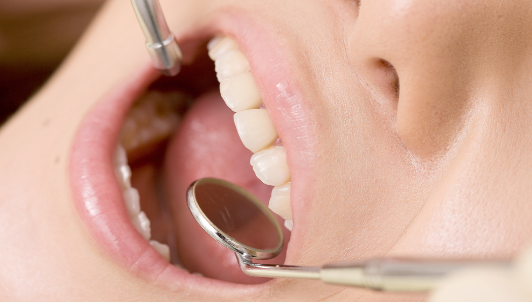 千葉市若葉区の歯周外科治療