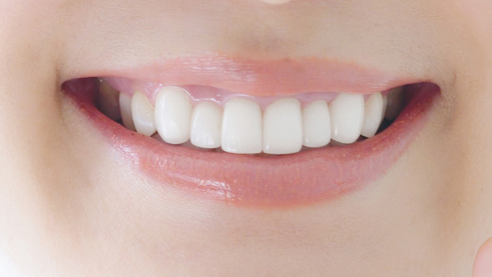 千葉市若葉区のホームホワイトニング