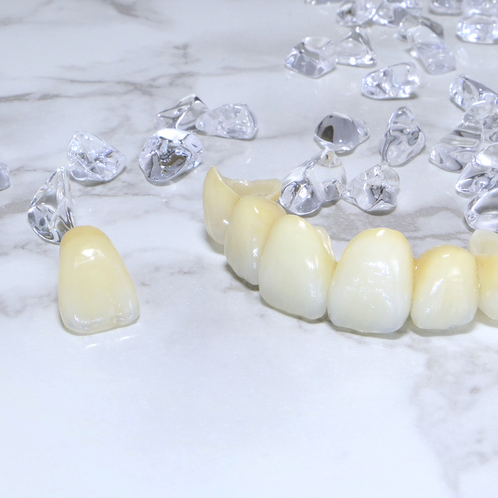 千葉市若葉区の審美歯科（白い詰め物・被せ物）