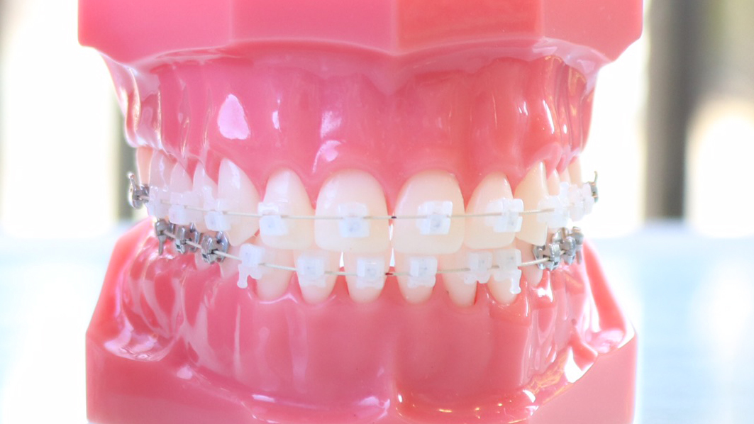 千葉市若葉区の矯正歯科