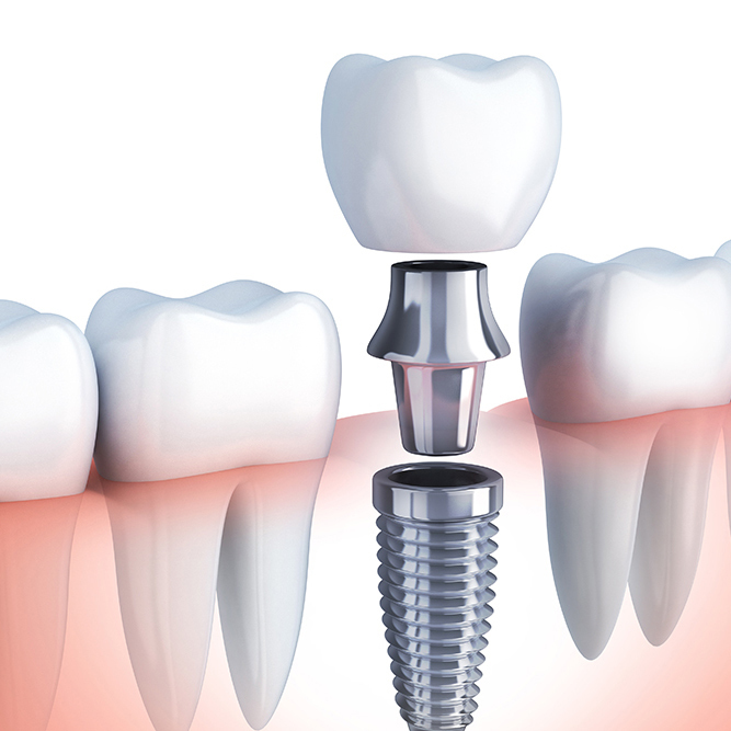 千葉市若葉区でおすすめの歯医者・歯科医院｜原田歯科クリニック