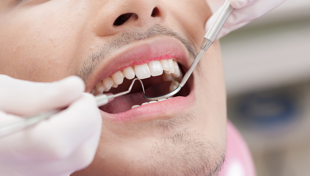 千葉市若葉区の親知らずの抜歯・治療