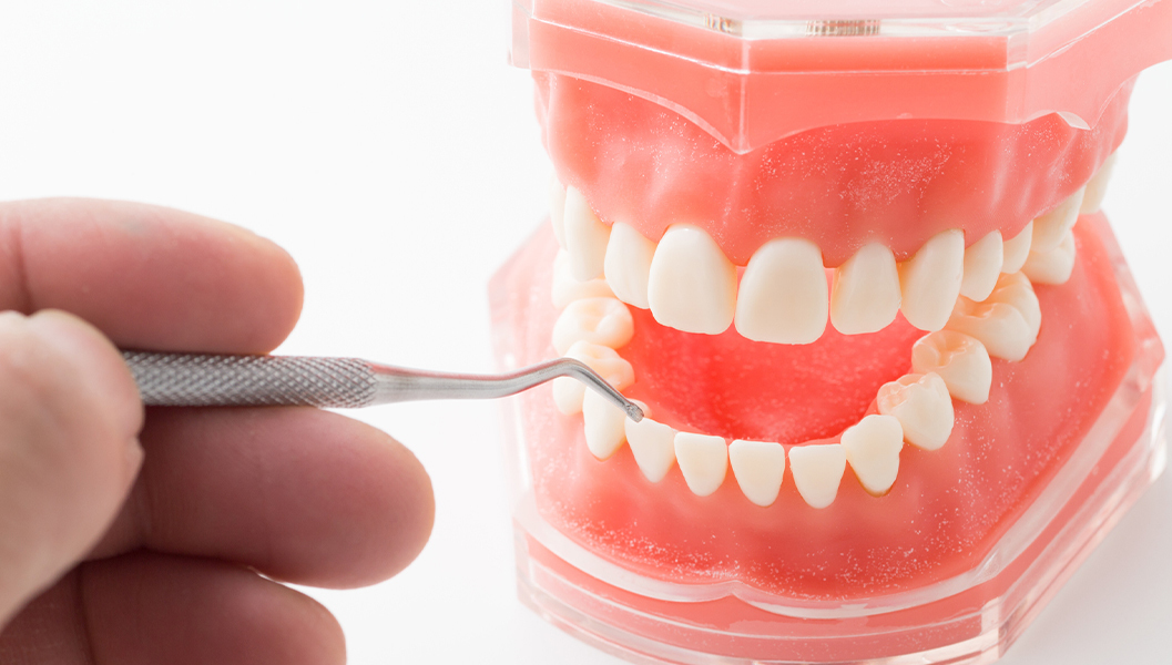 千葉市若葉区の歯周外科治療