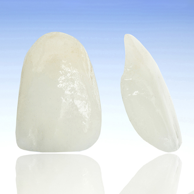 千葉市若葉区の審美歯科（白い詰め物・被せ物）