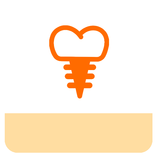 千葉市若葉区のインプラント治療