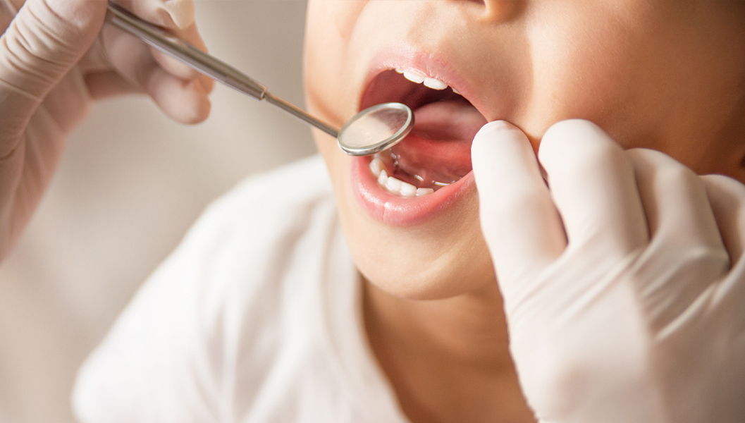 千葉市若葉区の小児矯正