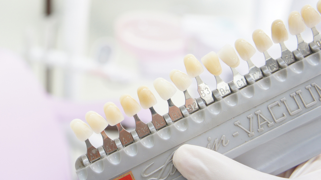 千葉市若葉区の審美歯科（白い詰め物・被せ物）