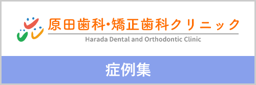 千葉市若葉区の歯科医院の症例集