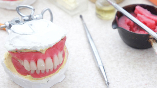 千葉市若葉区の入れ歯の治療