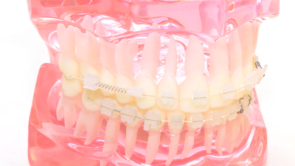 千葉市若葉区の矯正歯科