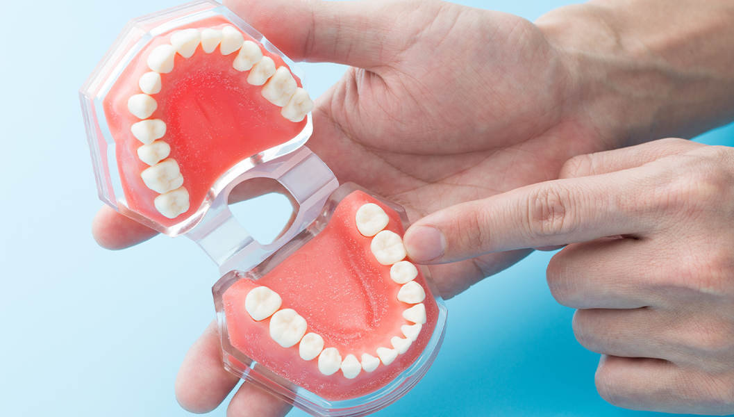 千葉市若葉区のジルコニア治療