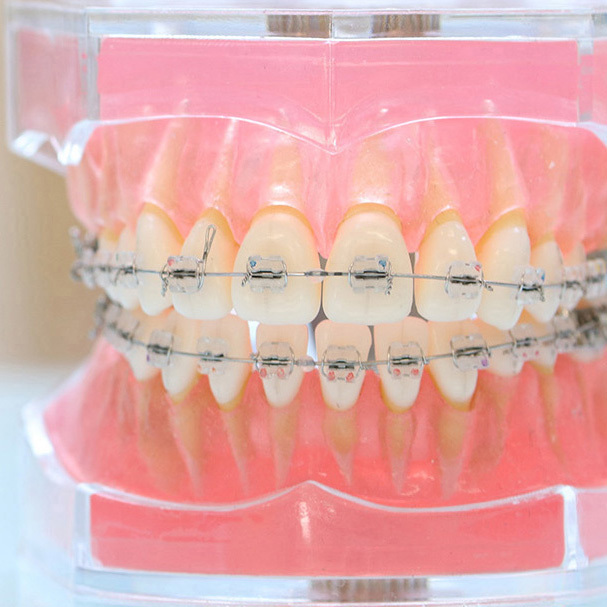 千葉市若葉区の矯正歯科