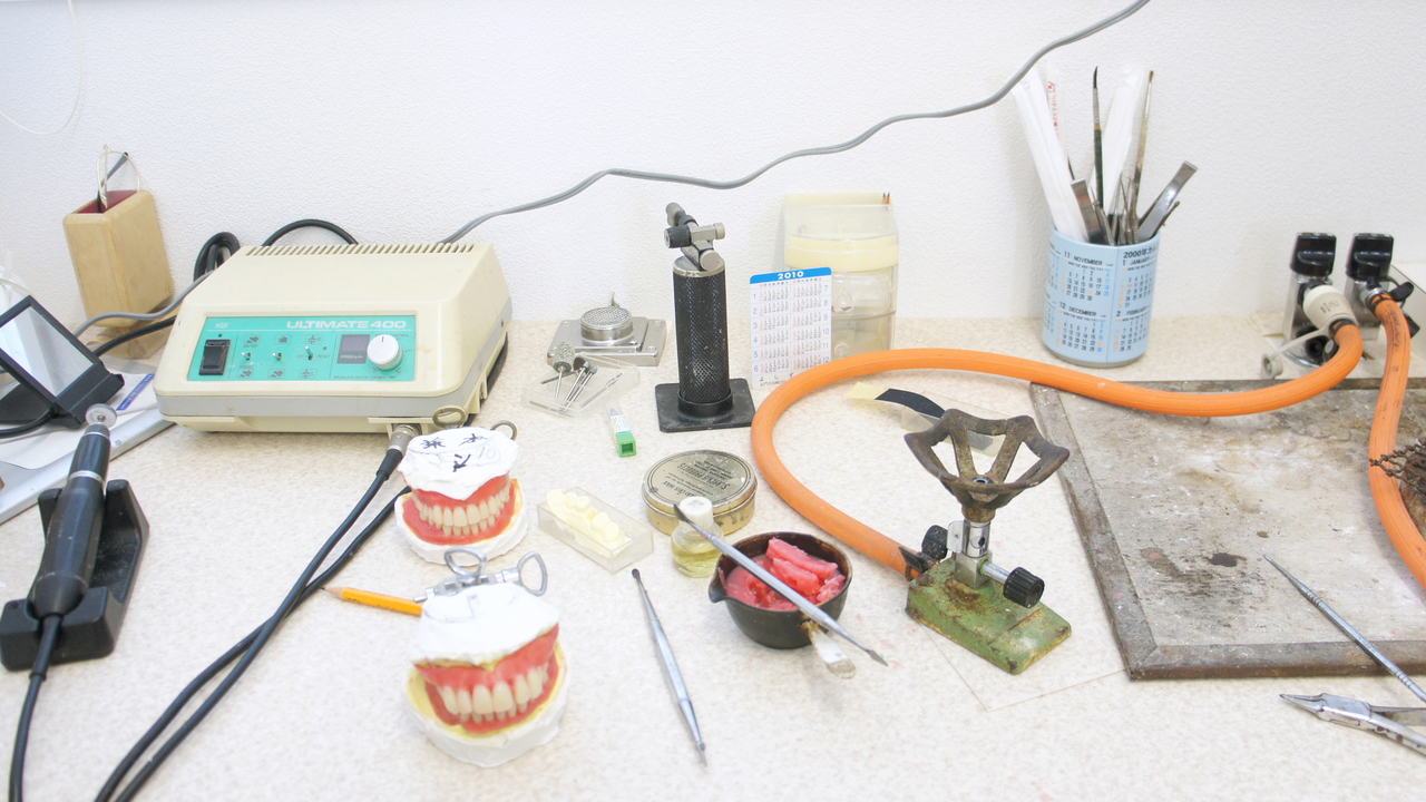 千葉市若葉区の入れ歯の治療