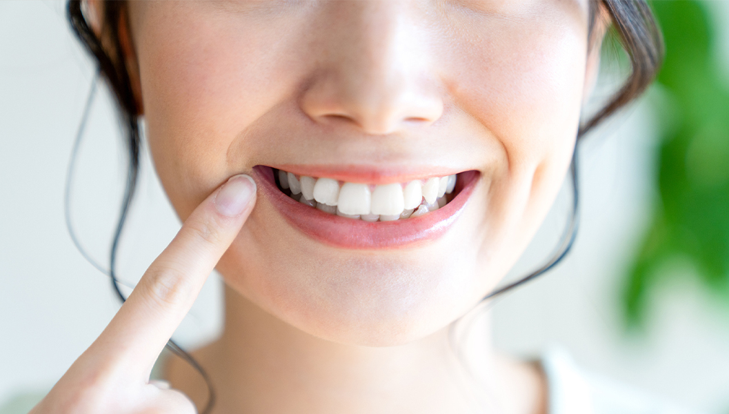 千葉市若葉区のダイレクトボンディング