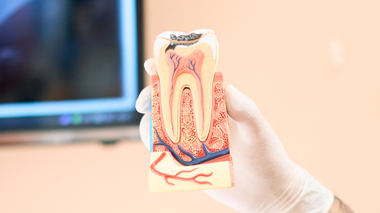 千葉市若葉区の精密根管治療