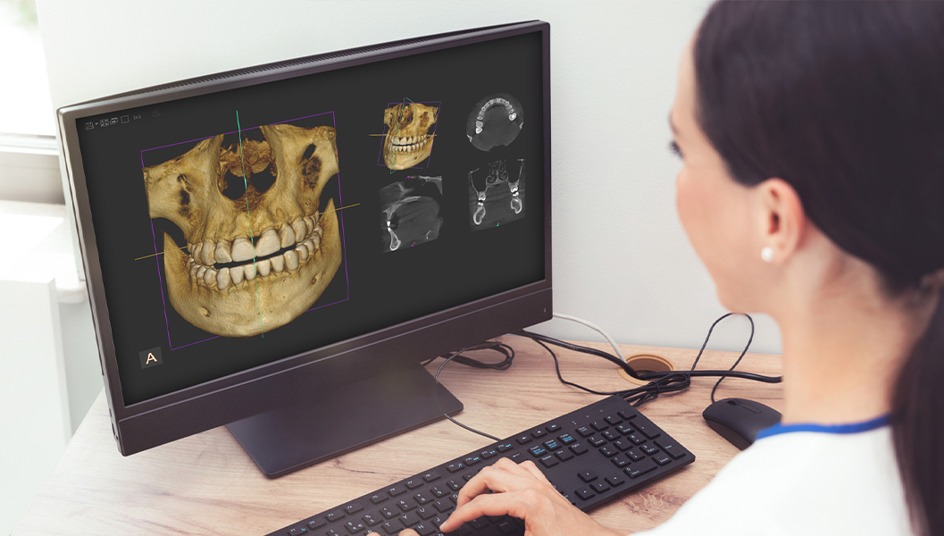 千葉市若葉区の精密根管治療