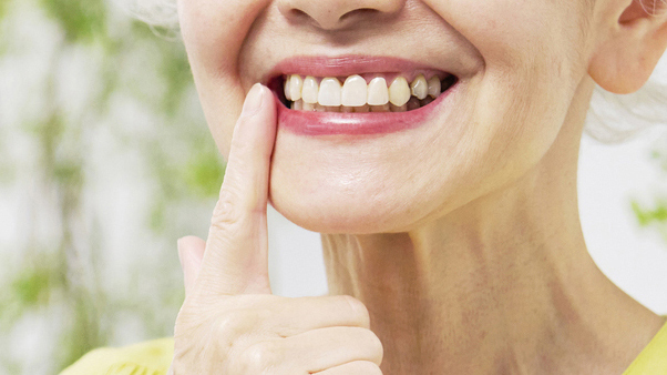 千葉市若葉区の入れ歯の治療