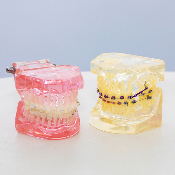 千葉市若葉区の小児矯正