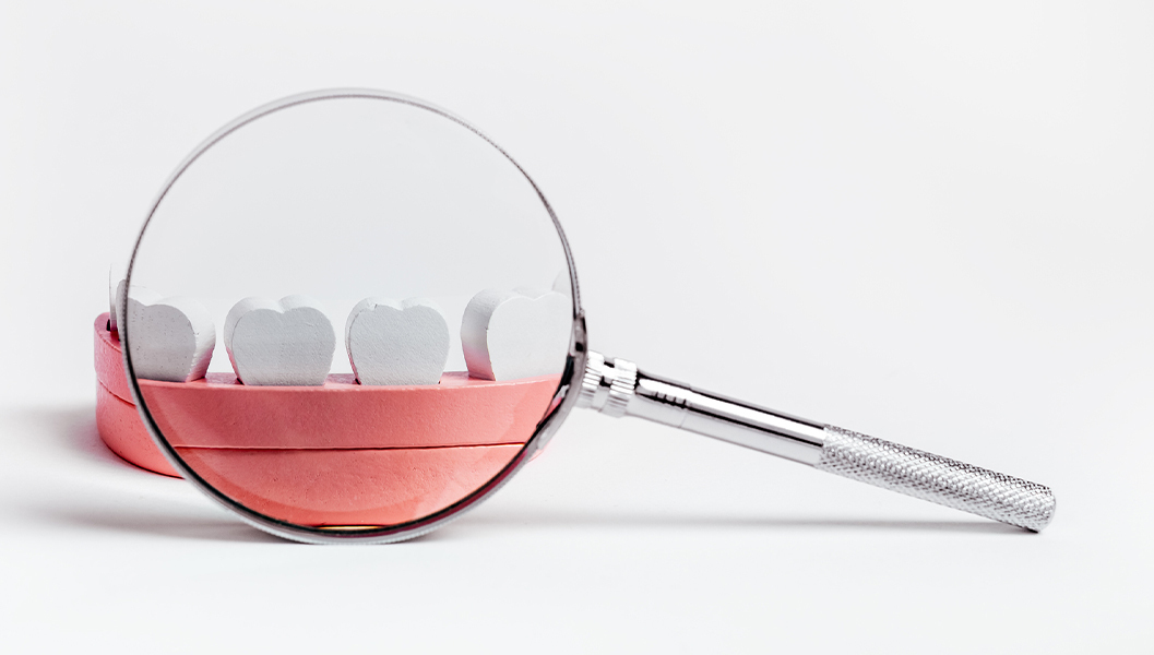 千葉市若葉区の歯周組織再生療法